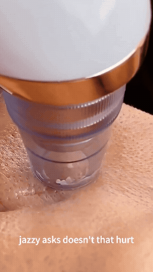 Blackhead Remover Pore Vacuum