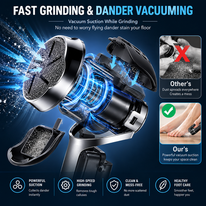 Electric Callus Remover for Feet