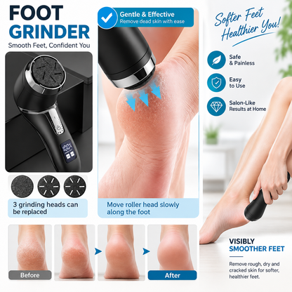 Electric Callus Remover for Feet