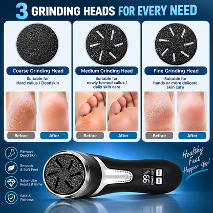 Electric Callus Remover for Feet